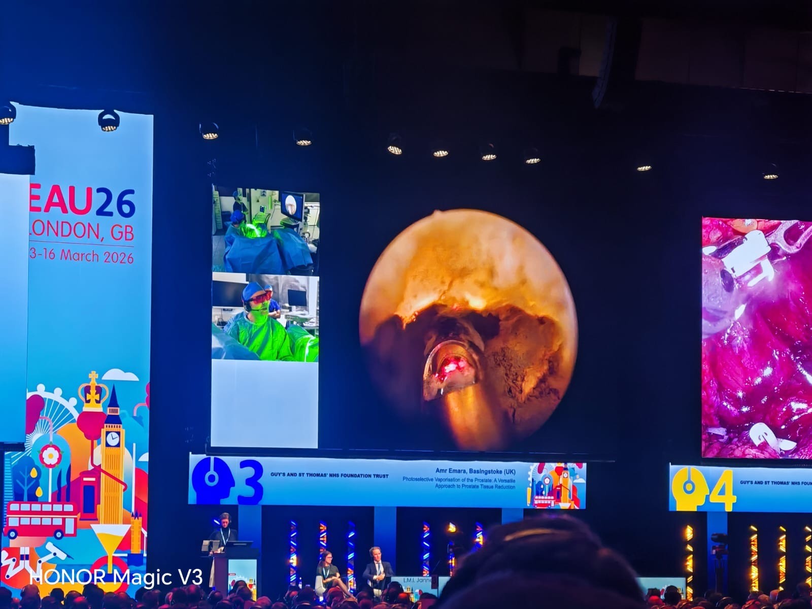 Our Consultant Surgeons Shine at EAU Annual Congress 2026